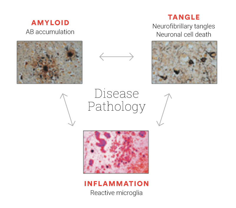 Pathology – Cure Alzheimer's Fund