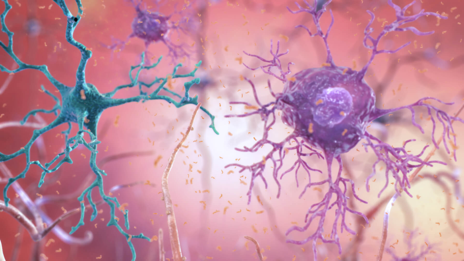 Microglia And Astrocytes In Alzheimer's Disease
